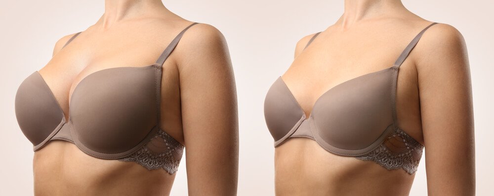 fake vs real looking boobs