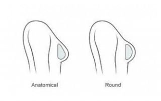 breast implants size2