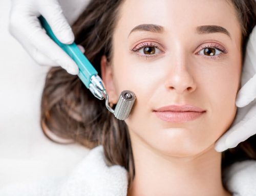 Does Microneedling for Acne Scars Work?