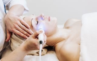 Laser Treatment for Broken Capillaries and Sun-Damaged Skin