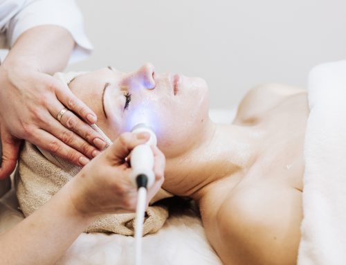 Laser Treatment for Broken Capillaries