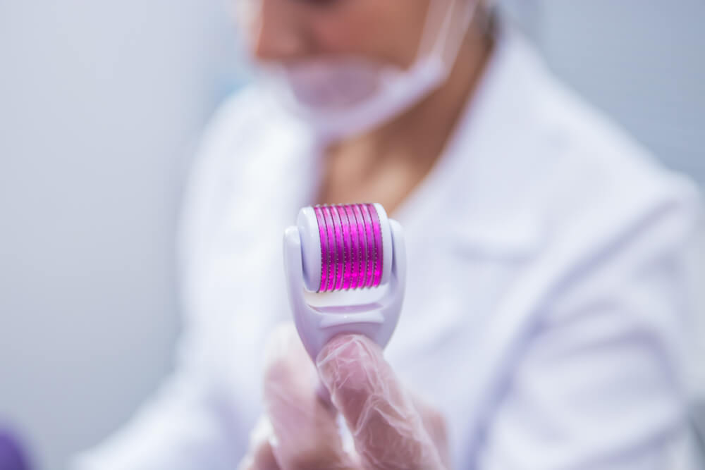 What Is Microneedling