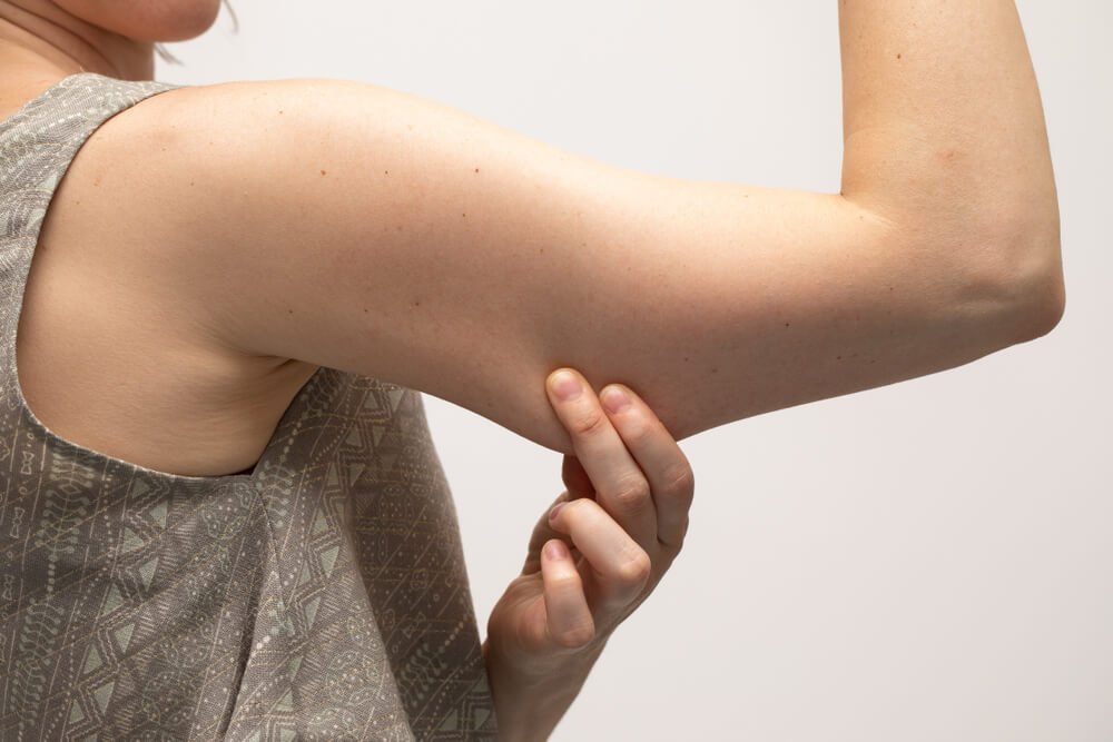 A Woman Pinching the Loose and Saggy Muscles in the Upper Arm
