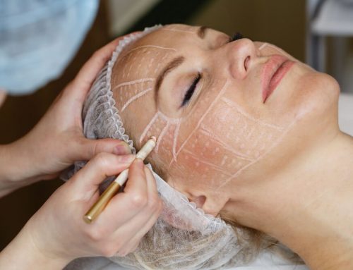 What Is the Short-Scar Facelift?