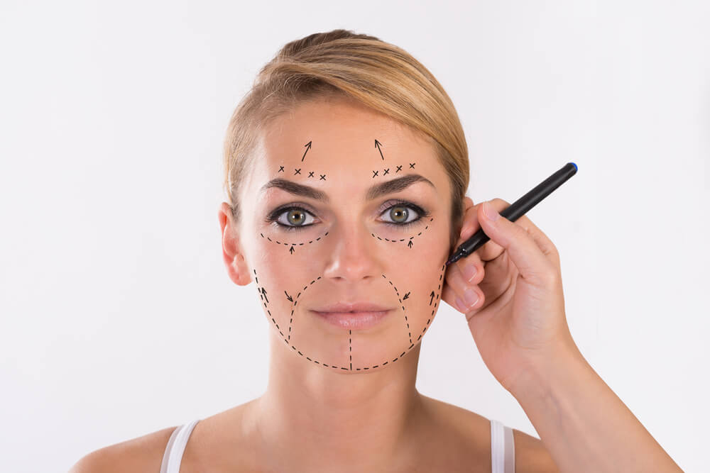Portrait of Young Woman Undergoing Facelift Surgery Over White Background