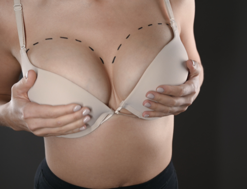 Breast Augmentation